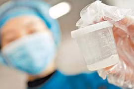 Bạn có biết về ngân hàng tinh trùng và thụ thai từ tinh trùng đông lạnh 15 năm?