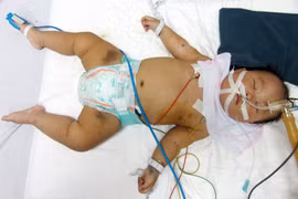 Vì quá nghèo, hai mẹ con uống thuốc diệt cỏ, mẹ chết, con 1 tuổi đang nguy kịch