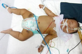 Vì quá nghèo, hai mẹ con uống thuốc diệt cỏ, mẹ chết, con 1 tuổi đang nguy kịch