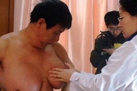 Nỗi khổ của những quý ông có bộ ngực “khủng”