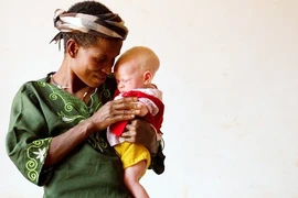 Người bạch tạng sống trong hãi hùng