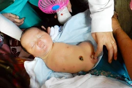 Cậu bé dị tật không chân tay kỳ lạ được phong làm "cậu hai" thần thánh ở An Giang