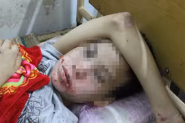 Cậu bé 14 tuổi bị hàng xóm nhốt để hành hạ, ép quan hệ quái đản