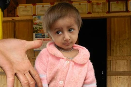 Chú bé “tí hon” 5 tuổi chỉ cao gần 50cm