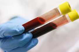 Làm rõ thông tin nghi ngờ nhân bản xét nghiệm tại BV Đa khoa Thạch Thất