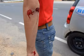 4 phóng viên bị côn đồ tấn công khi đang tác nghiệp