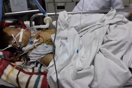 Bắt đối tượng dùng điếu cày đánh con trai dã man, gây chấn thương sọ não