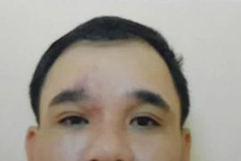 "Diễn kịch” tại quán bia, nhằm đòi tiền bảo kê