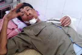 Trộm chó bị phát hiện, lao thẳng xe vào bảo vệ tổ dân phố