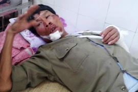 Trộm chó bị phát hiện, lao thẳng xe vào bảo vệ tổ dân phố