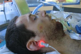 "Người chó" khỏa thân gây náo loạn giao thông