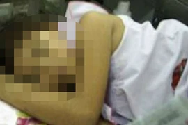 Bố dượng nhiều lần hiếp con riêng 10 tuổi