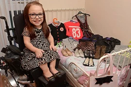 Bé gái người Anh 15 tuổi chỉ cao 80 cm