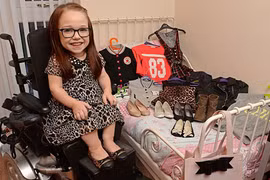 Bé gái người Anh 15 tuổi chỉ cao 80 cm