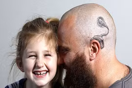 Ông bố vĩ đại xăm lên đầu giúp con gái vượt qua mặc cảm