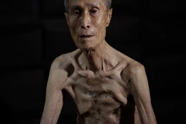 Người đàn ông Nhật Bản may mắn sống sót sau vụ ném bom nguyên tử năm 1945