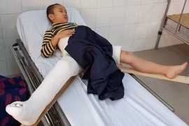 Chi tiết kết luận của Chủ tịch UBND TP Hà Nội về vụ cháu Trần Chí Kiên bị gãy chân ở trường