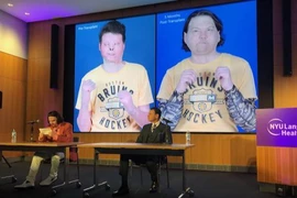 Người đầu tiên trên thế giới được ghép mặt và tay cùng lúc 