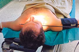 Bị tên bắn xuyên cổ không chết