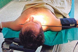 Bị tên bắn xuyên cổ không chết