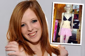 Bị chế giễu, cô gái nhịn ăn gầy như xác khô