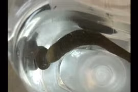 Khiếp vía nhìn đỉa dài 10 cm sống trong cổ họng suốt 2 tháng