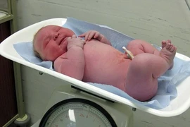 Bé sơ sinh nặng tới 6,5 kg