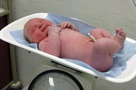 Bé sơ sinh nặng tới 6,5 kg