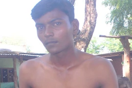 18 năm sống với quả tim ngoài lồng ngực