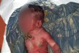 Đáng thương bé gái sơ sinh bị bỏ rơi trong thùng rác, kiến bu đầy