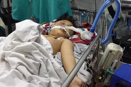 Bé trai 8 tuổi nguy kịch vì bị bố đánh man rợ bằng điếu cày