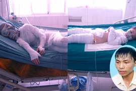 Giáp mặt gã trai hắt cả xô axit vào gia đình ông chủ