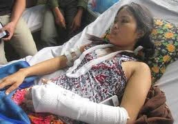 Nỗi ám ảnh kinh hoàng của người bị chồng cũ rạch mặt, cắt gân tay