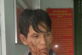 Trọng án ở Đồng Nai: Thiếu nợ 800 ngàn đồng nên làm liều?