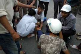 Đi xe ngược chiều bị “tông” gãy chân