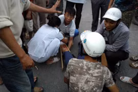 Đi xe ngược chiều bị “tông” gãy chân