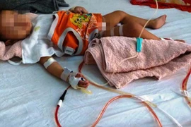 Kỷ luật khiển trách bác sỹ cắt nhầm bàng quang bệnh nhi