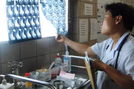 Rút ngắn thời gian chẩn đoán lao xuống dưới 2 giờ