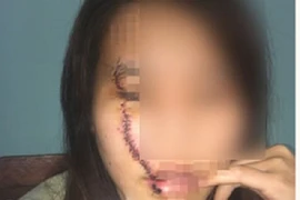 Nữ sinh 16 tuổi rạch mặt dã man một phụ nữ giữa đường
