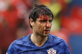 Sốc với hình ảnh hậu vệ Croatia mặt be bét máu sau va chạm