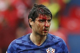 Sốc với hình ảnh hậu vệ Croatia mặt be bét máu sau va chạm
