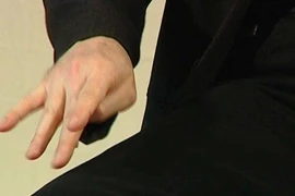 Dấu hiệu sớm của bệnh Parkinson