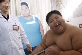 Điều trị cho bé 10 tuổi nặng 155kg