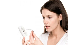 Phụ nữ cũng bị hói đầu như nam giới