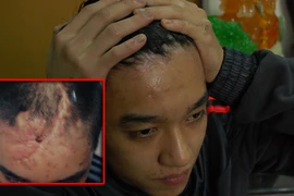 Bị bắn suýt chết, được hỗ trợ 1 triệu đồng?