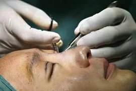 Mốt làm đẹp bằng... dao kéo