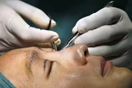 Mốt làm đẹp bằng... dao kéo