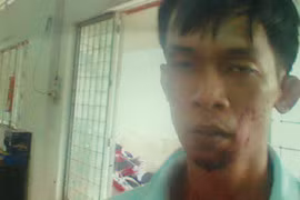 Khởi tố, bắt giam CSCĐ tấn công CSGT giữa phố