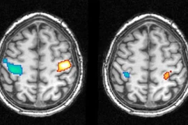 Con người tự chọn giấc mơ?