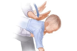 Truy tố bảo mẫu trong vụ cháu bé 7 tháng tuổi bị sặc sữa tử vong